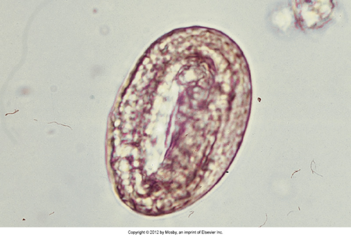 <p>pigs I. host earthworm bronchi or bronchioles cough obstructions in airway</p>