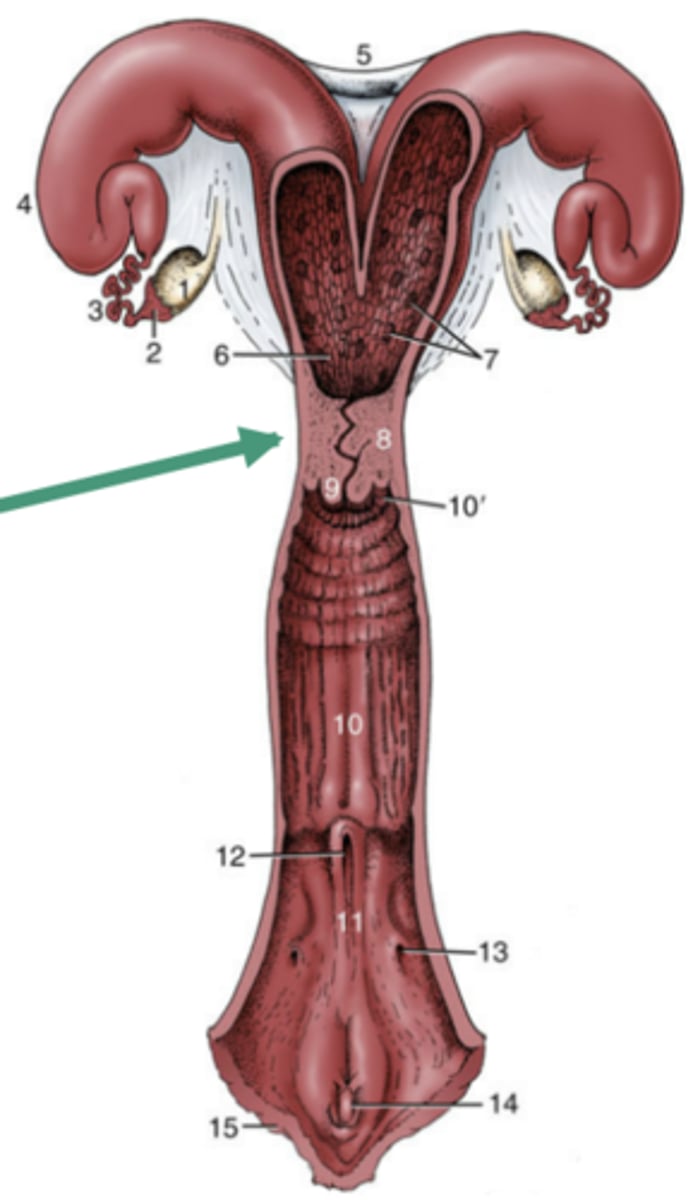 <p>-Sphincter that acts as physcial and chemical barrier to outside enviroment</p><p>-thickened, contrition caudal portion of the uterus</p><p>-fibrous elastic tissue + muscle</p><p>-highly responsive to hormones that fluctuate throughout estrous cycle</p><p>-located within the pelvic cavity</p>