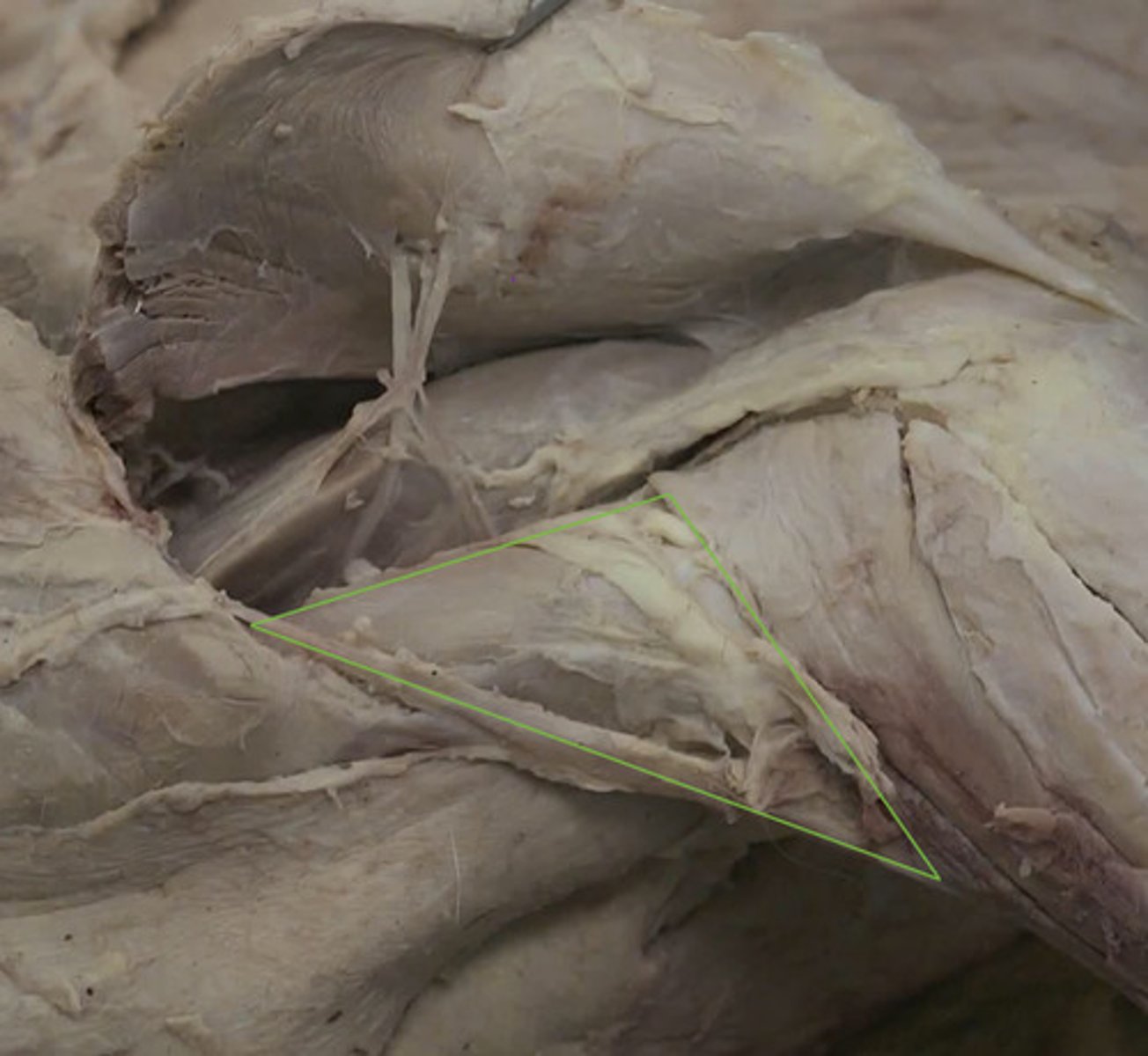 <p>Origen: caudal cuello húmero</p><p>Inserción: prx. radio (medial) y cúbito</p><p>Origen: en el cuello del húmero (caudolateral)</p><p>inserta en la parte craneomedial del radio distal a la articulación del codo.</p><p>Función: flexor de codo.</p><p>Inervación: n musculocutáneo.</p><p>Región: Discurre sobre el surco del músculo braquial el húmero. Sobre él se localiza el n. radial.</p>