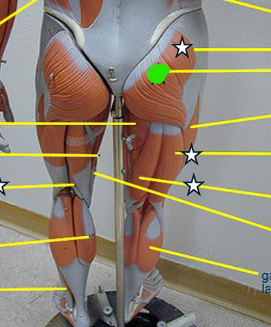 <p>Extends and laterally rotates the thigh </p><p></p><ul><li><p>you have to remove the gluteus maximus in order to view the gluteus medius </p></li></ul><p></p>