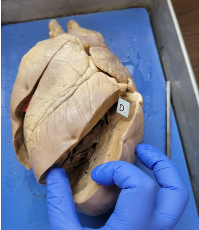 <p>the left ventricle </p>