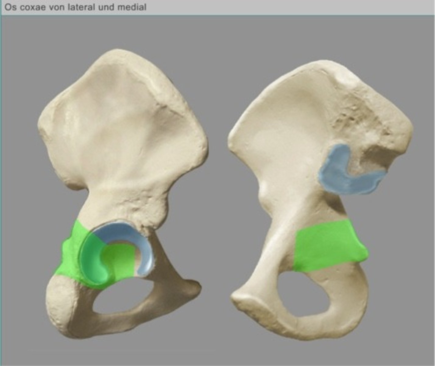 <p>corpus ossis ischii</p>