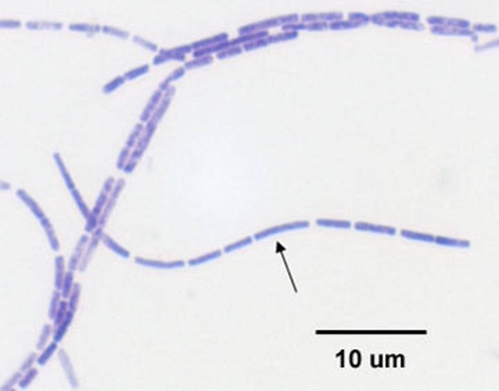 <p>rod-shaped bacterial cells</p>