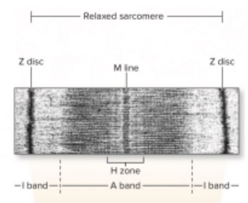 <p>H band/H zone</p>