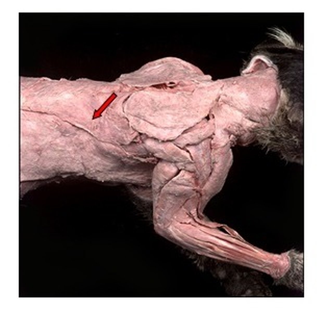 <p>origin: spines of thoracic vertebrae</p><p>insertion: spine of scapula</p><p>action: pulls scapula back and caudal</p>