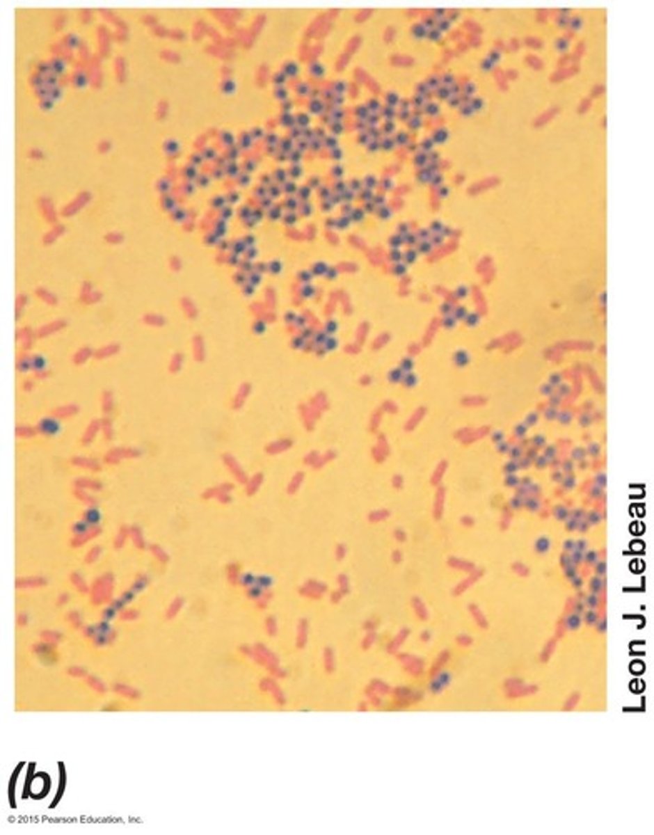<p>Widely used differential stain in microbiology.</p>