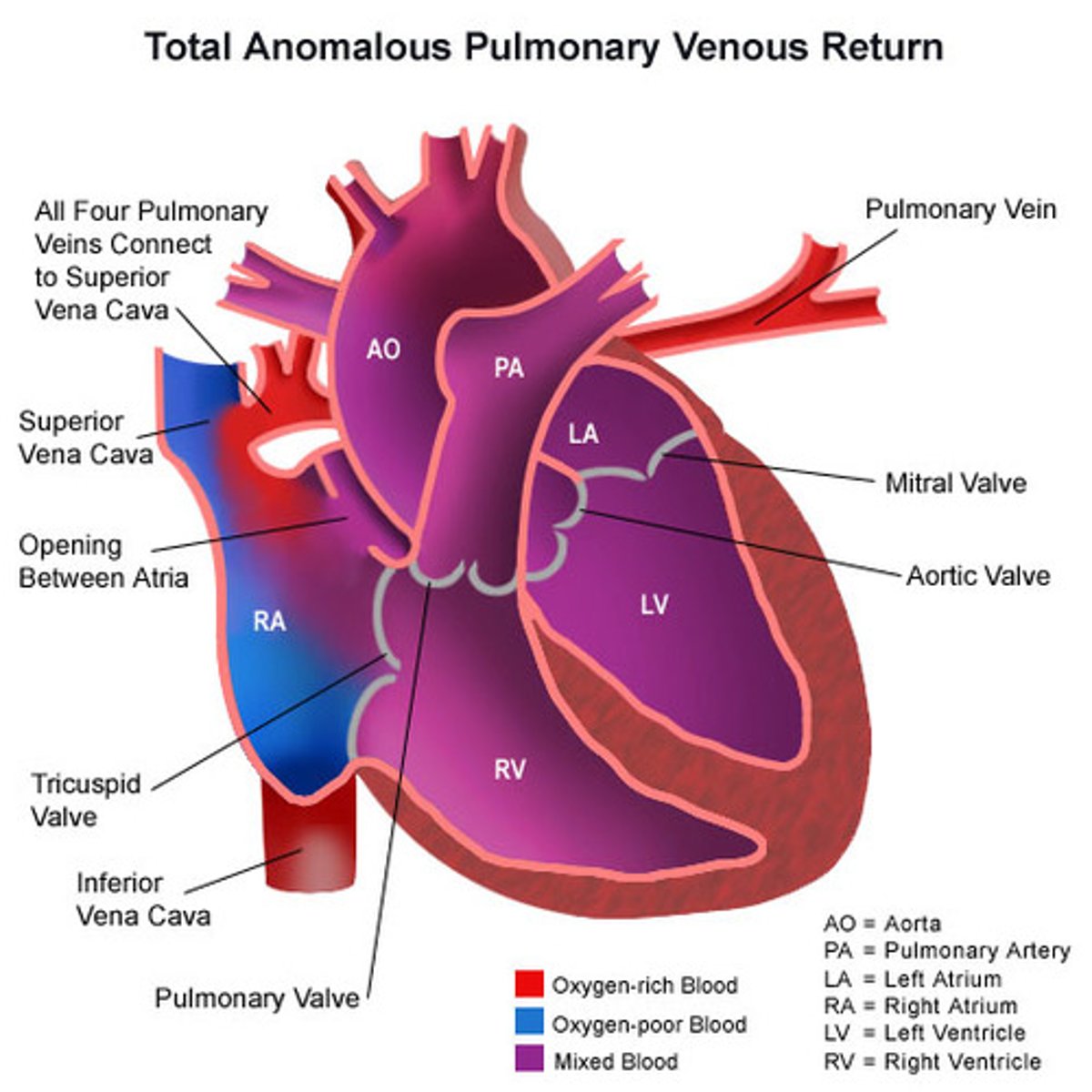 <p>What is the definition of venous return (VR)? </p>