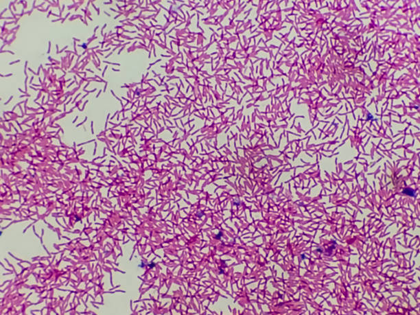 <p>a resident inside a human body; can become deadly. What is this?</p>