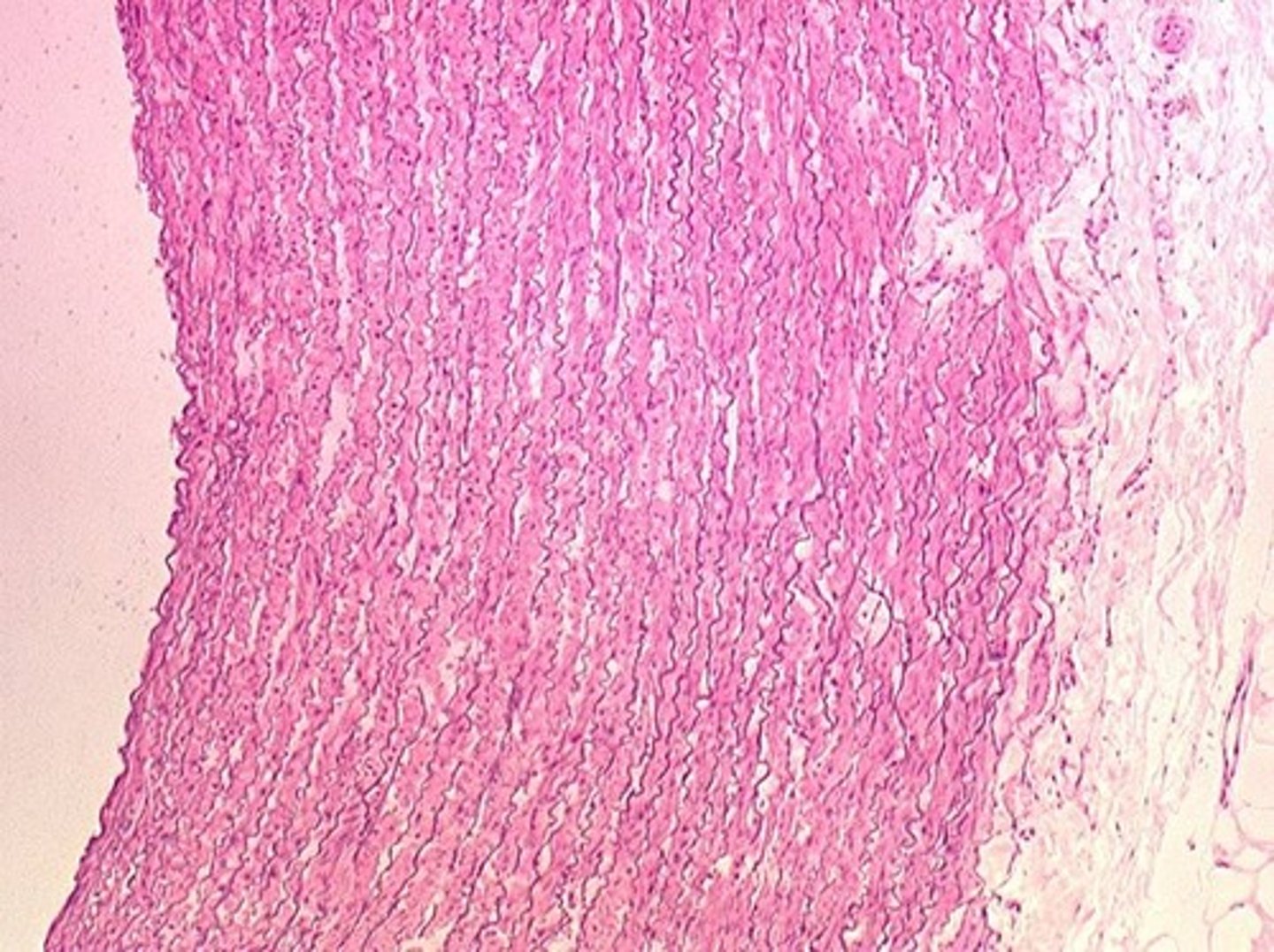 <p>Artery with high elasticity to accommodate blood pressure.</p>
