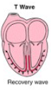 <p>signal used to allow the heart to rest to prepare for the next beat</p>