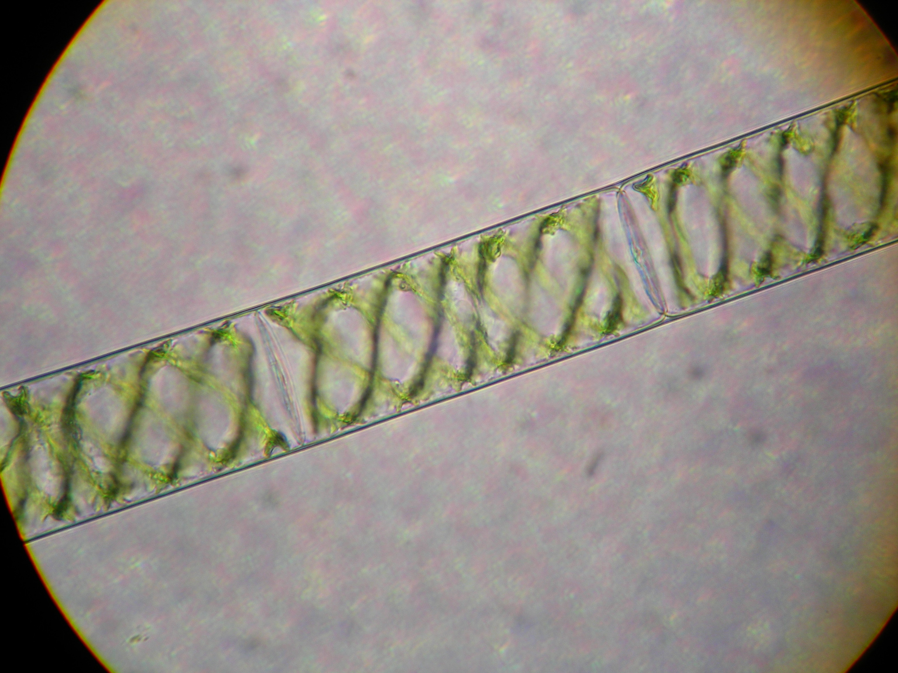 <p>Which protist is this?</p>
