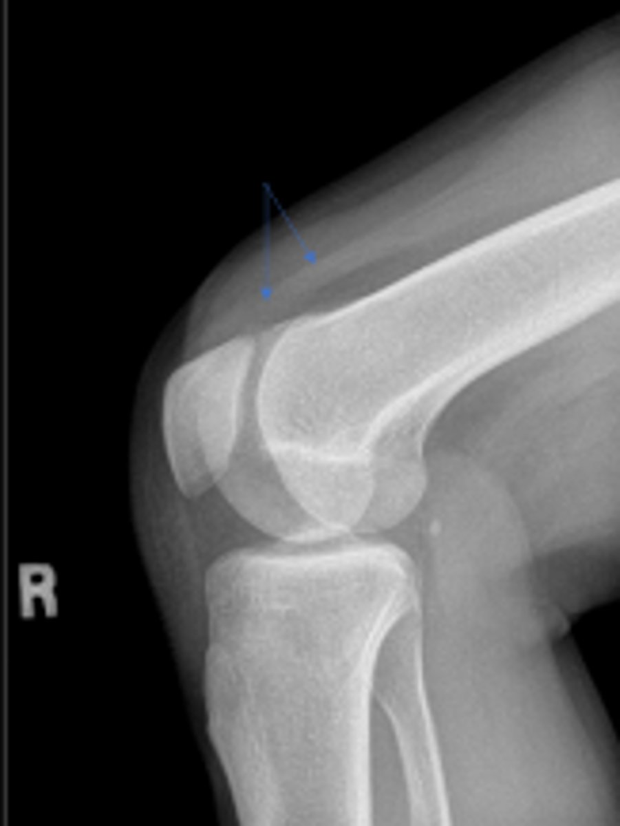 <p>What is outlined?</p>