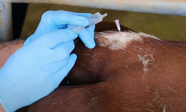 <p>Check if in right spot - hanging drop technique</p><ul><li><p>Drop some local anaesthetic into the needle</p></li><li><p>If in the right space the drop should get sucked in via negative pressure</p></li></ul><p></p><p>Other method - get som air into syringe with the drug and inject - should go in easily (don’t inject the air though)</p>