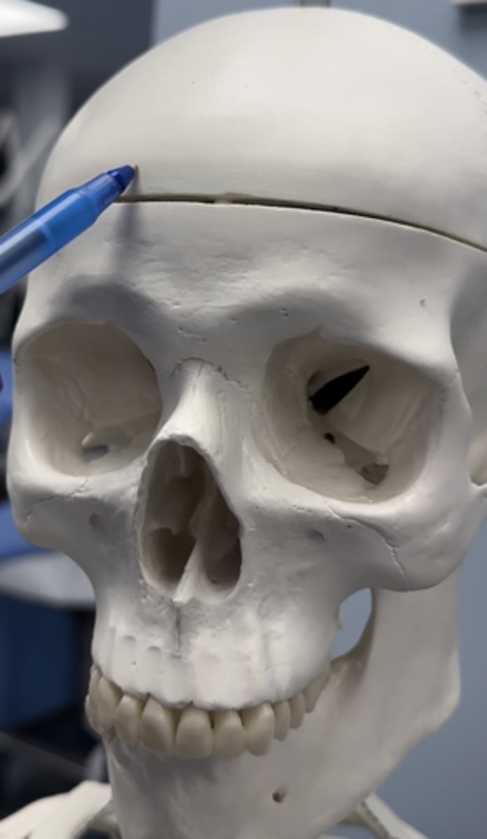 <p>Pointed at is</p>