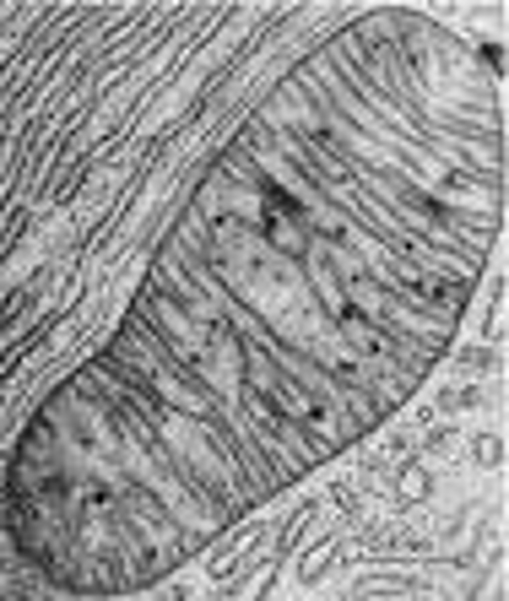 <p>A form of electron microscopy in which an image is derived from electrons that have passed through the specimen, in particular one in which the whole image is formed at once rather than by scanning.<br>Up to 100,000x magnification.</p>