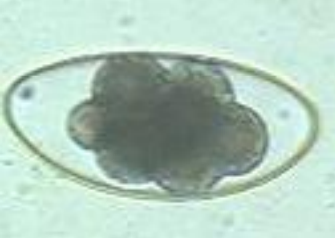 <p>name the parasite and describe egg:</p>