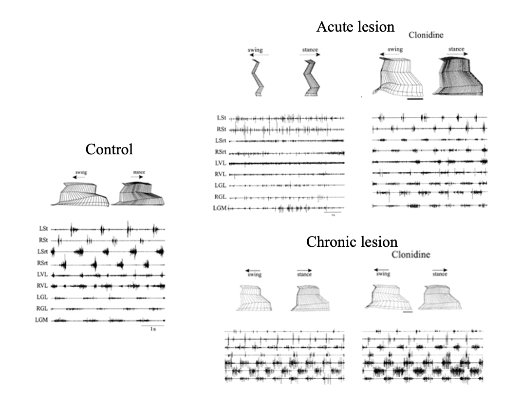 <ol><li><p>extent of injury</p></li><li><p>time after injury→ Chlonidine is only effective soon after a spinal lesion (acute vs chronic lesions)</p></li><li><p>Reliable experimetntal effects may not be translated to the clinic</p></li></ol><p></p>