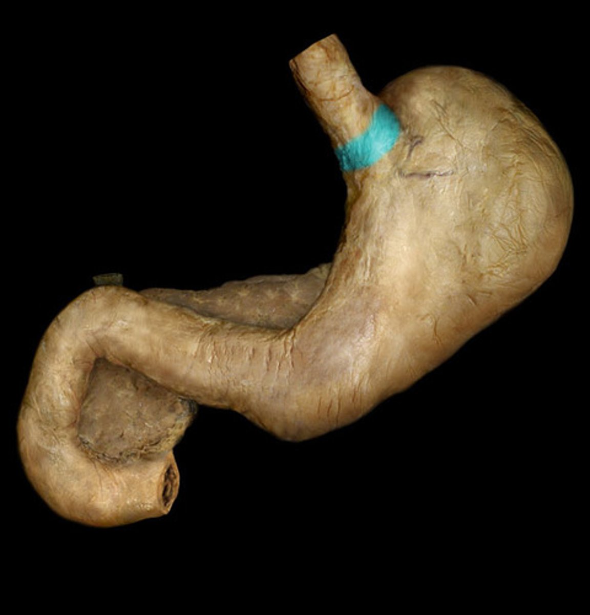 <p>Point where esophagus connects to the stomach</p>