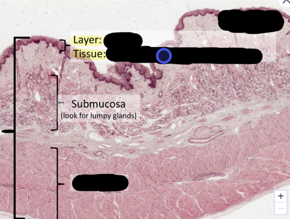 <p>what type of tissue is this?</p>