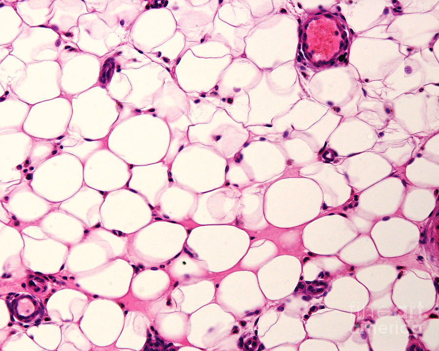 <p>What kind of Loose Connective Tissue is this? Where do you find it?</p>
