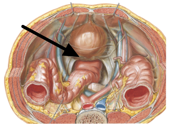 <p>what is indicated by the arrow?</p>