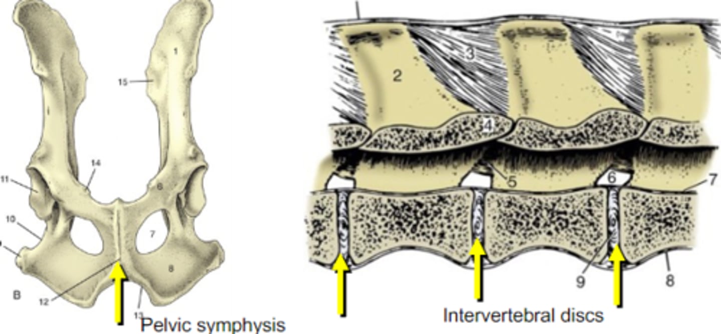 <p>Fibrocartilaginous joint between two bones</p>