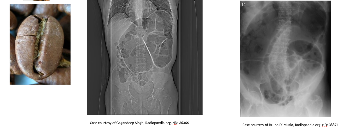 <p>on a radiograph →</p><p></p>
