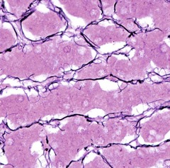 <p>Structure: Branching small fibers</p>