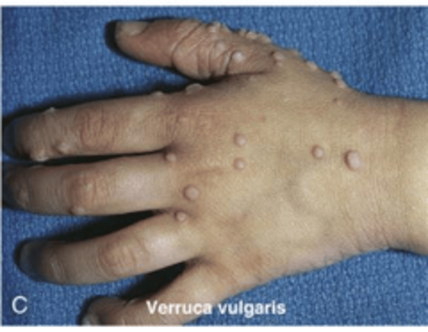 <p>Hands</p>