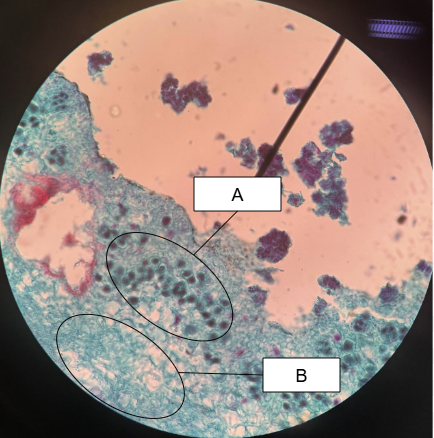 <p>What is this called</p>