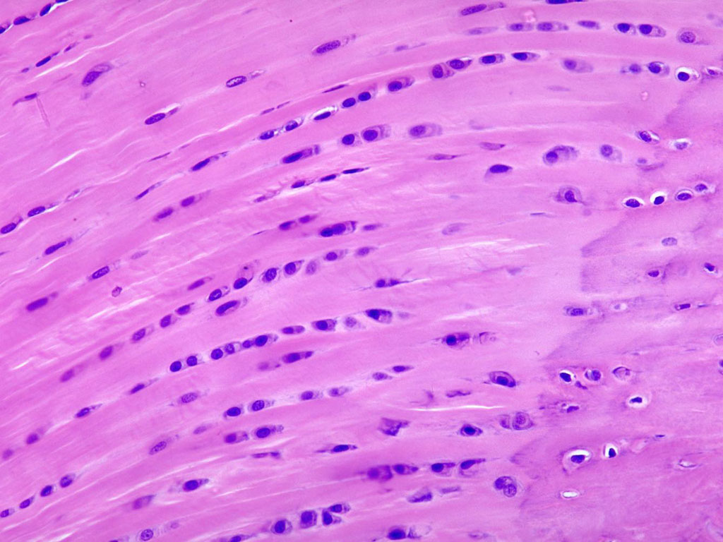 <p>Fibrocartilage</p>