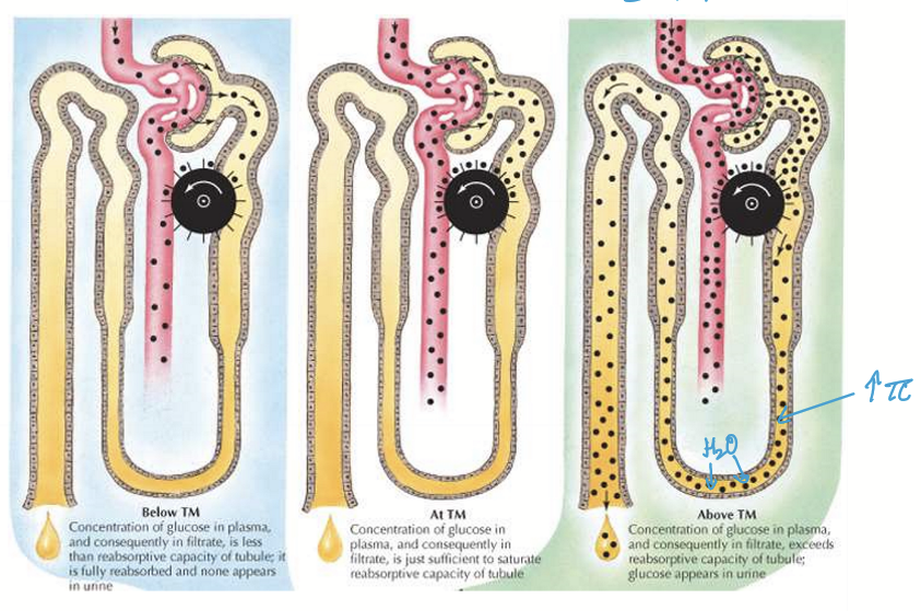<ul><li><p>Normal blood glucose &lt; Tm : complete reabsorption </p></li><li><p>Elevated blood glucose = Tm : complete reabsorption </p></li><li><p>High blood glucose &gt; Tm : pateint will have glucose in urine (<strong>glucosuria</strong>) and osmotic effect of excess glucose will cause osmotic diuresis, causing <strong>polyuria </strong></p></li></ul><p></p>