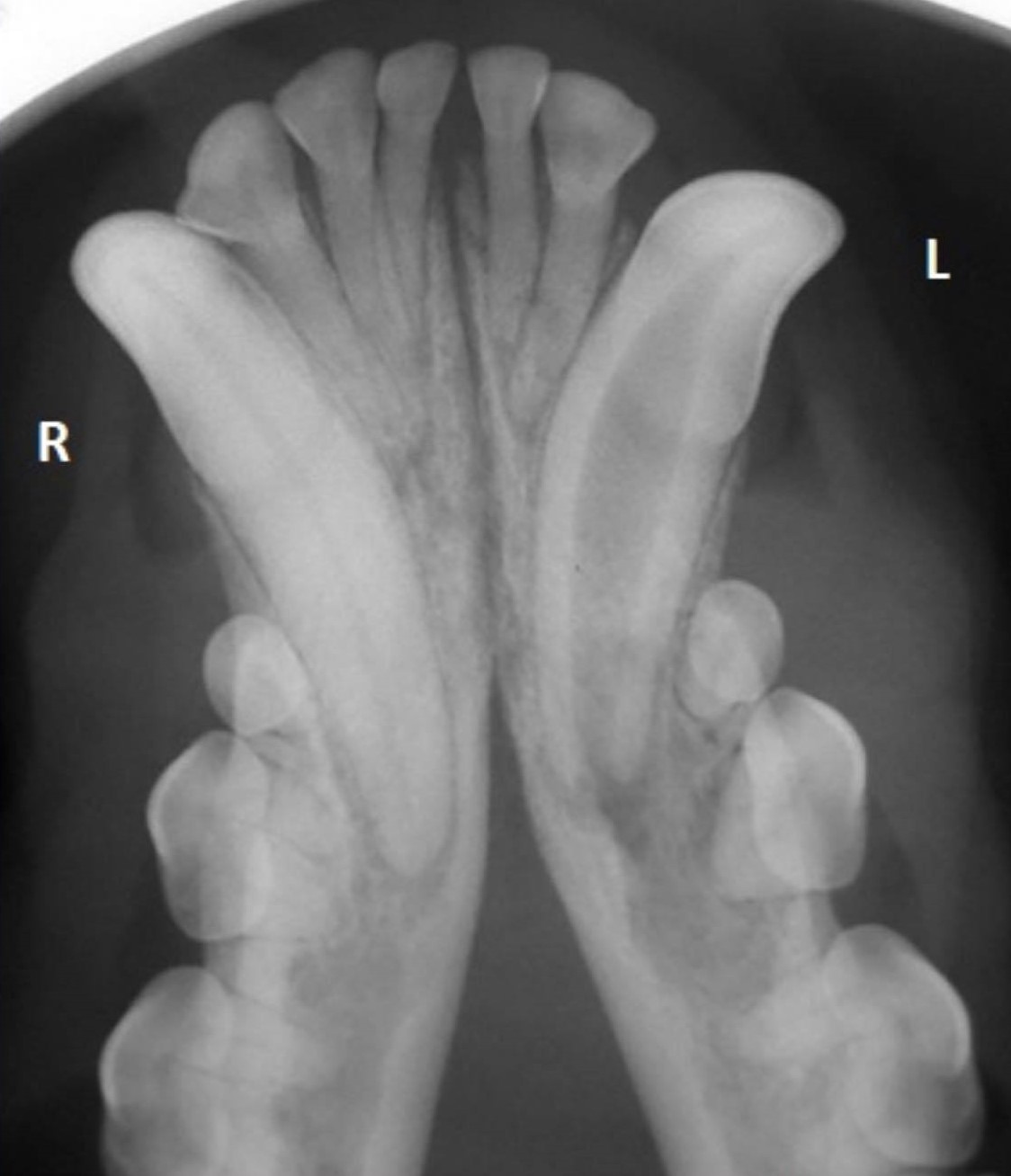 <p>Radiographic report - pathology</p>