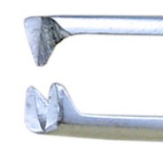 <p>Rat-tooth thumb</p>
