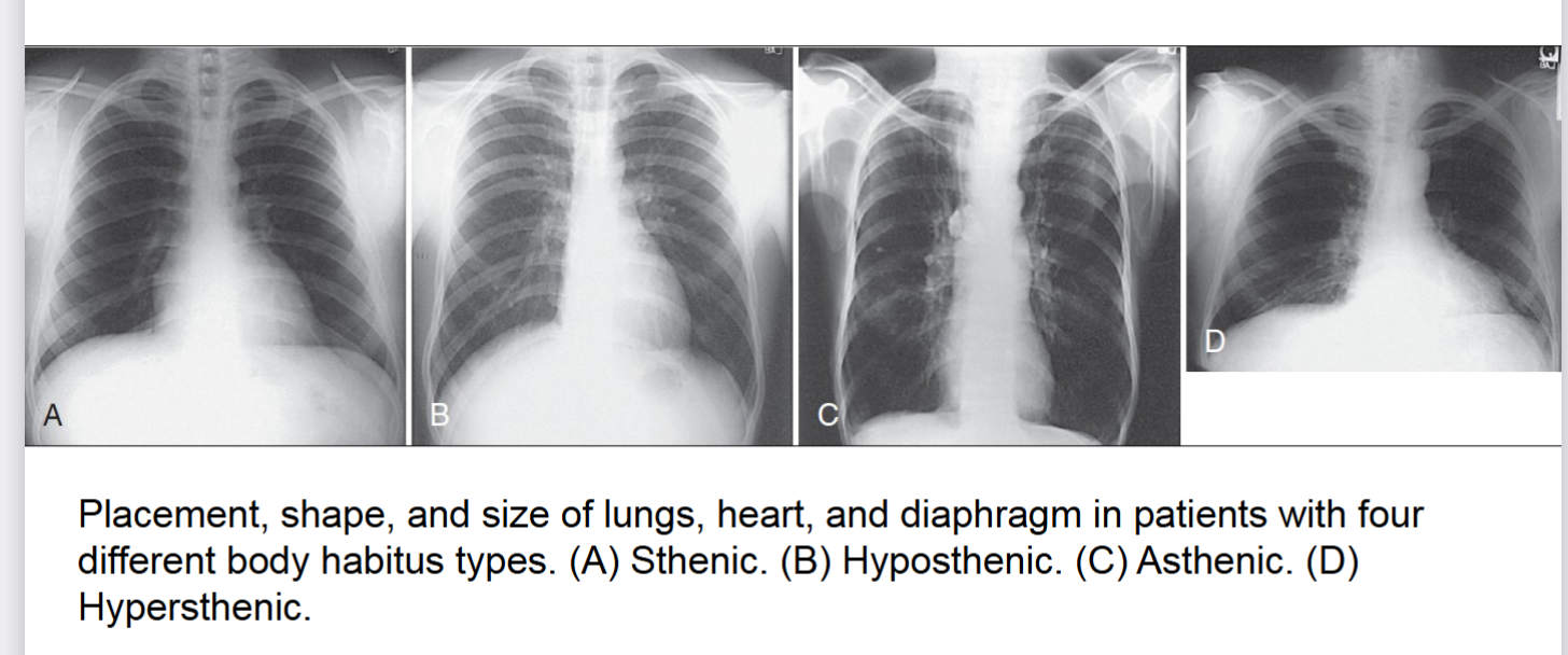 <p>hypersthenic </p>