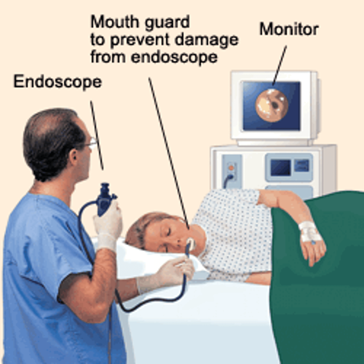 <p>A. CORRECT. The medical assistant should store the endoscope vertically so that any residual fluid can drain and the equipment can dry.</p><p>B. Storing the endoscope flat can cause moisture to pool within the tube.</p><p>C. Storing the endoscope in an airtight container does not allow the endoscope to dry properly and could cause contamination and bacteria growth.</p><p>D. The medical assistant should not place the endoscope in its original container because this could cause contamination and bacteria growth.</p>