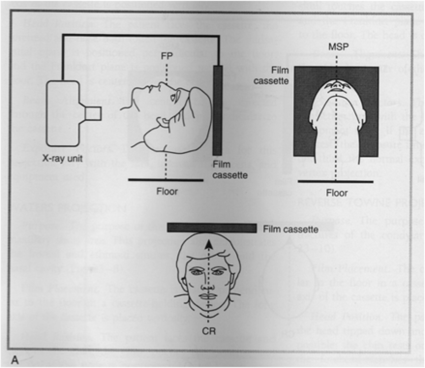 <p>identify position of the condyles, base of the skull, and evaluate fractures of the zygomatic arch</p>