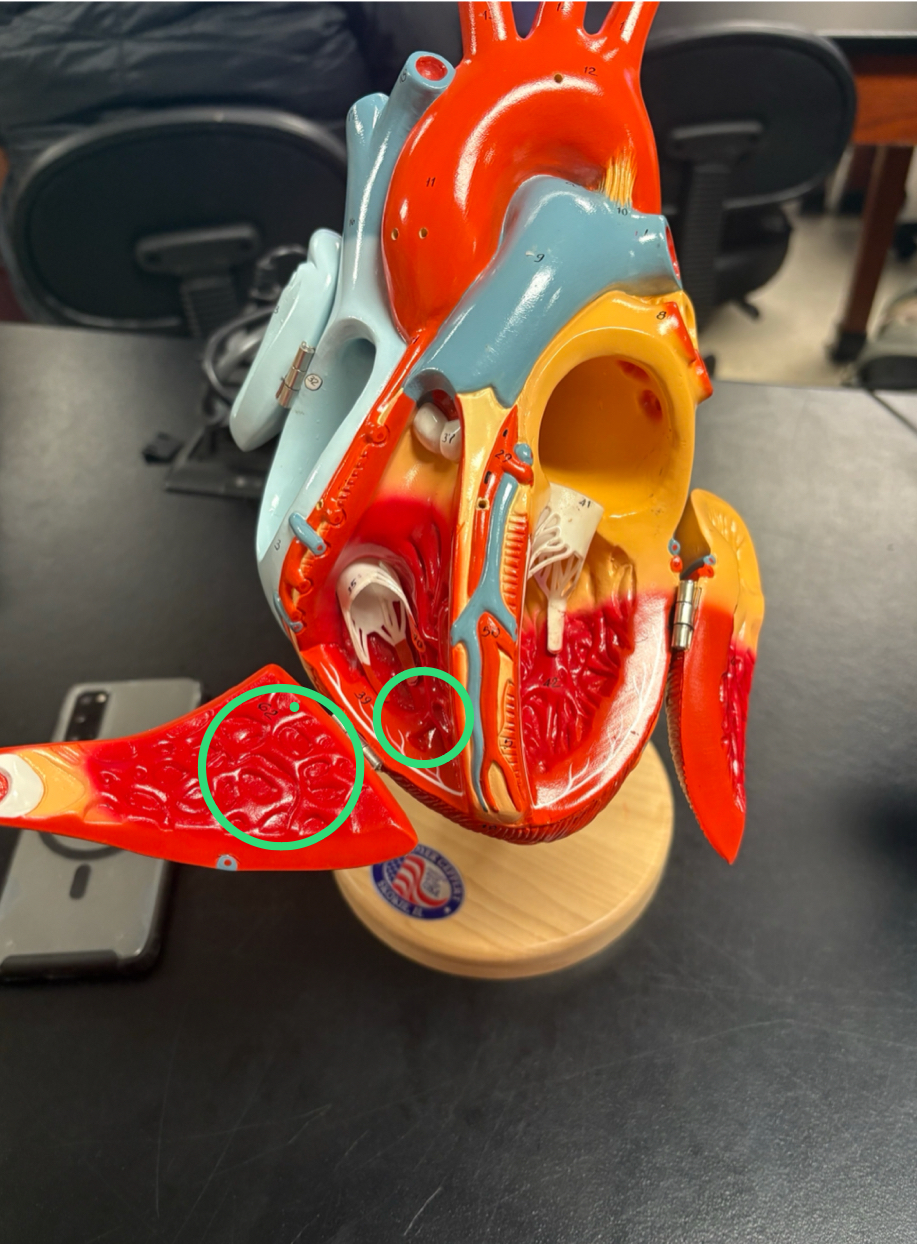 <p>irregular ridges of muscle inside the ventricles</p>