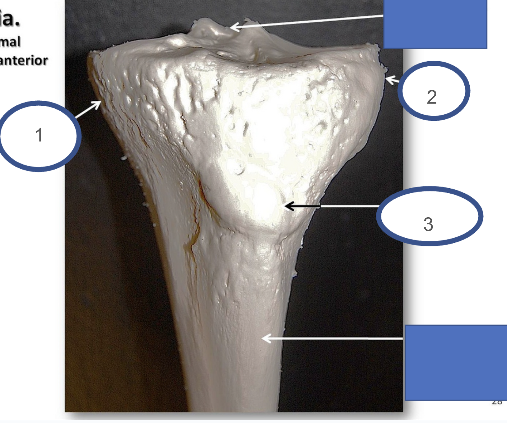 <p>what bone and view is this?</p>