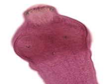 Close-up scolex of __________. In this focal plane, one of the suckers is clearly visible, as is the ring of rostellar hooks.