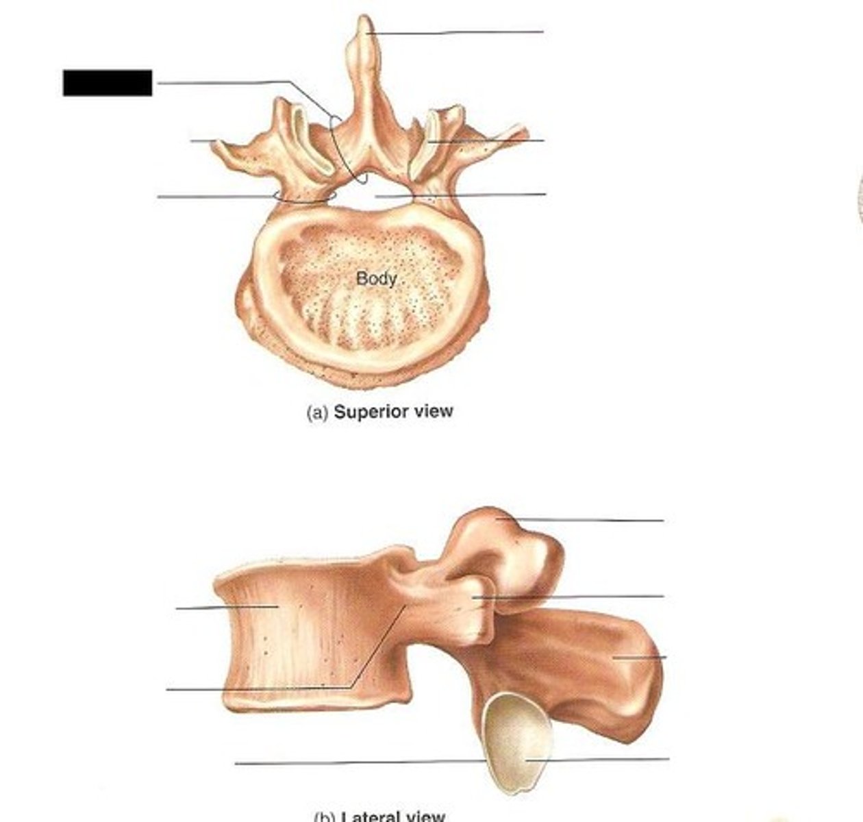 <p>Large kidney-shaped body, blunt spinous process</p>
