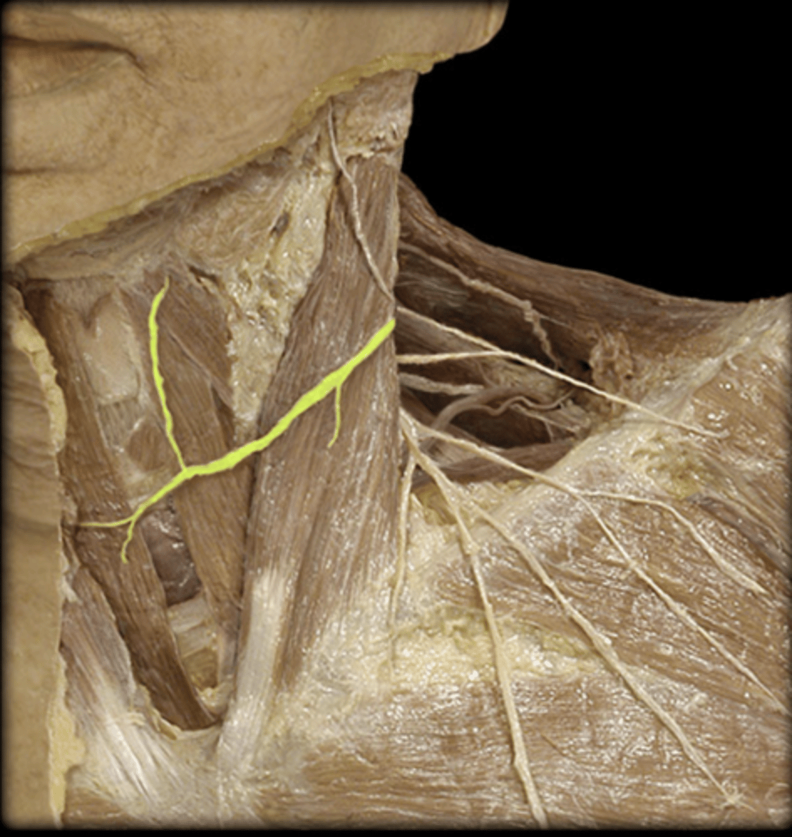 <p>identify the structure</p>