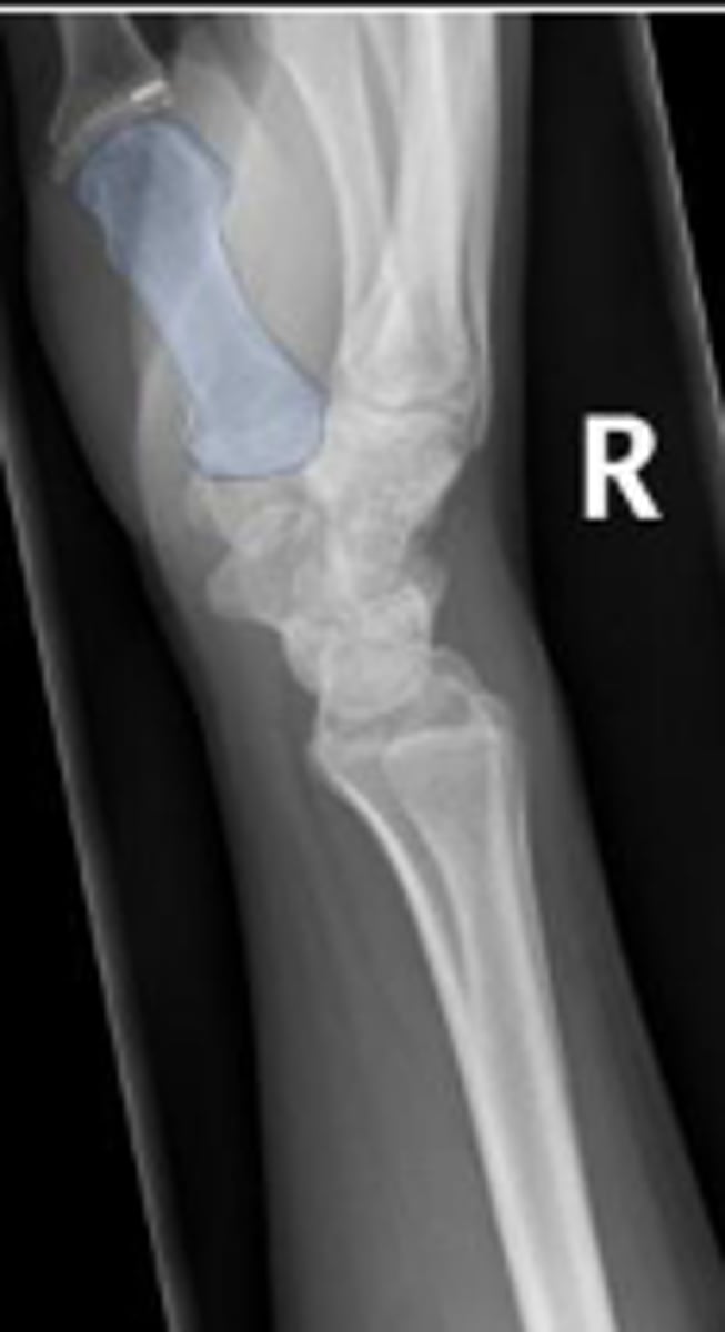 <p>What is outlined?</p>