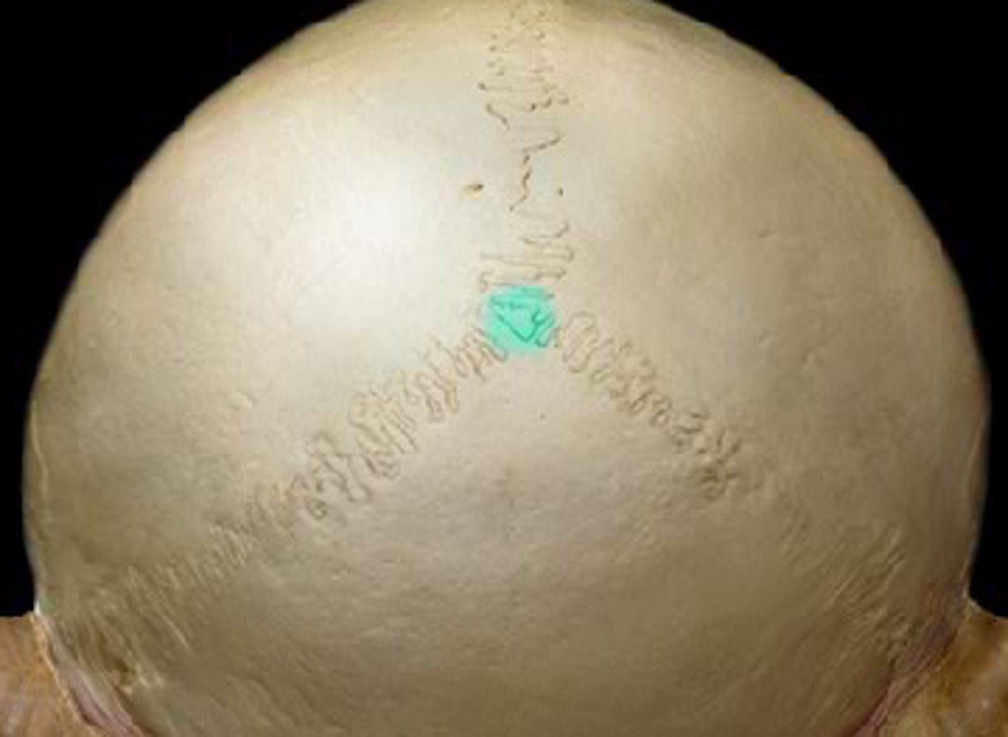 <p>Point where lambdoid suture meets sagittal suture.</p>
