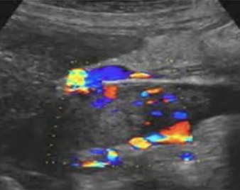 <p>has blood flow</p><p></p>