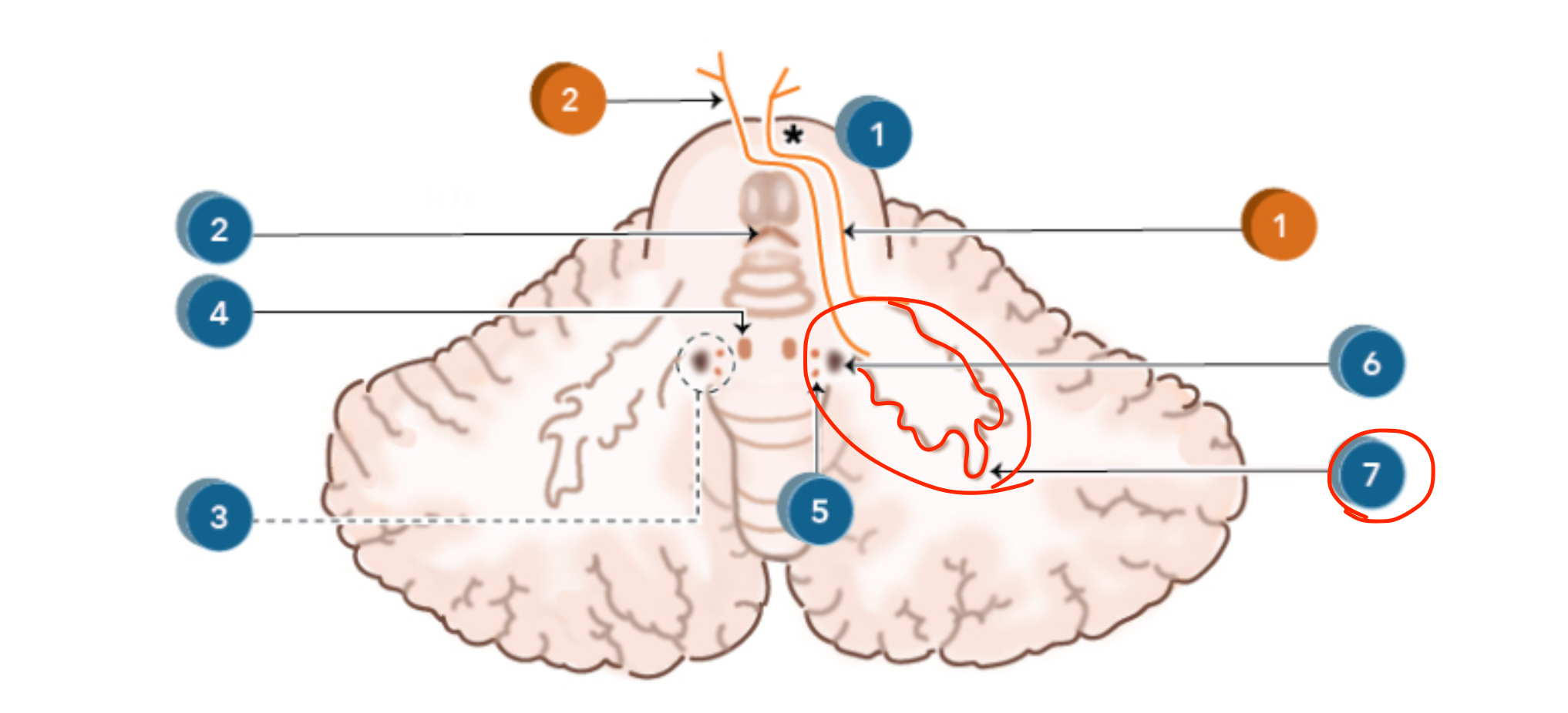 <p>Dentate nucleus</p>