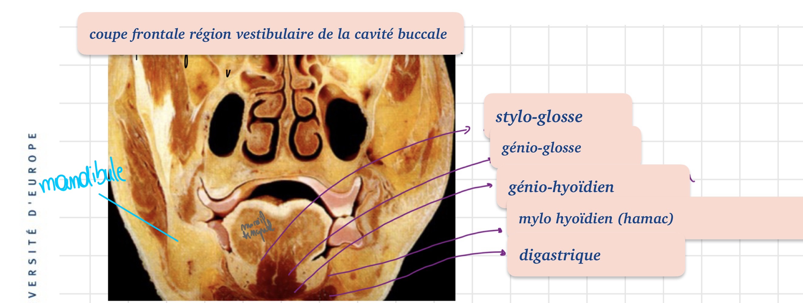 <p>• Le stylo-glosse<br>• Le génio-glosse<br>• Le génio-hyoïdien<br>• Le mylo-hyoïdien (forme un hamac)<br>• Le digastrique</p>