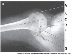 What projection (method) is demonstrated in the image?