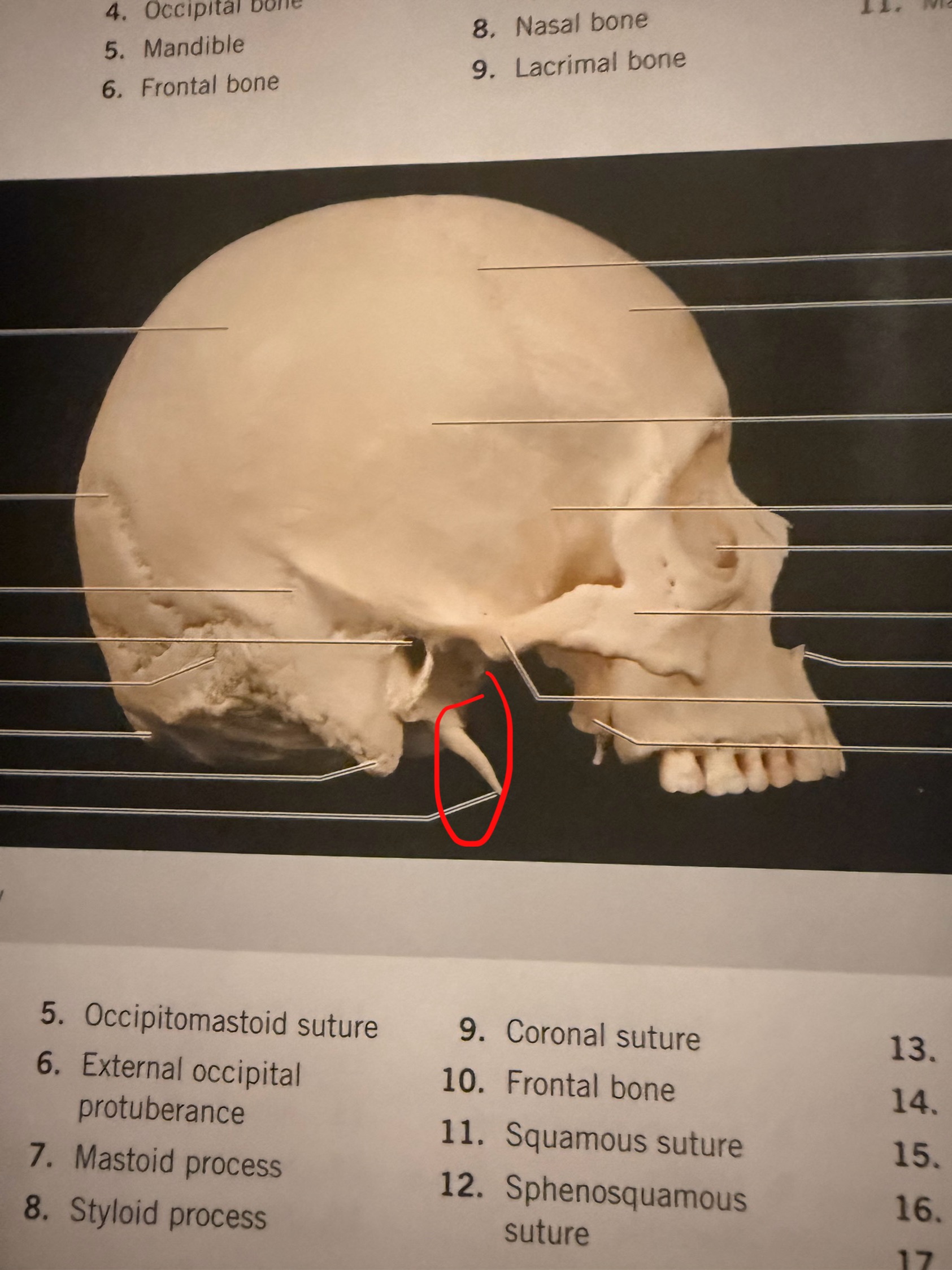 term image
