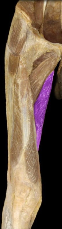 <p>Name the muscle highlighted (two words - all lowercase)</p>